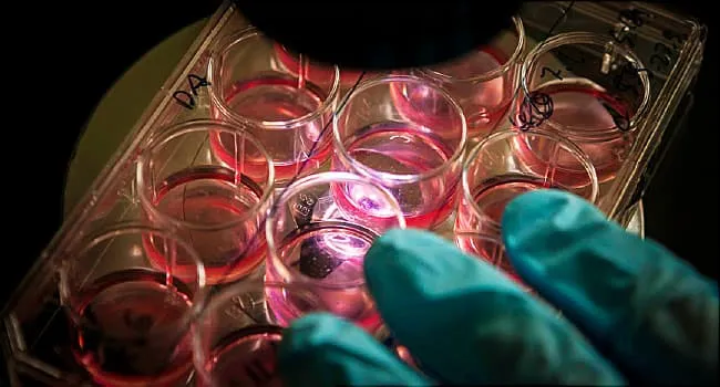 Multiple Myeloma Video on Risk Factors and Treatments