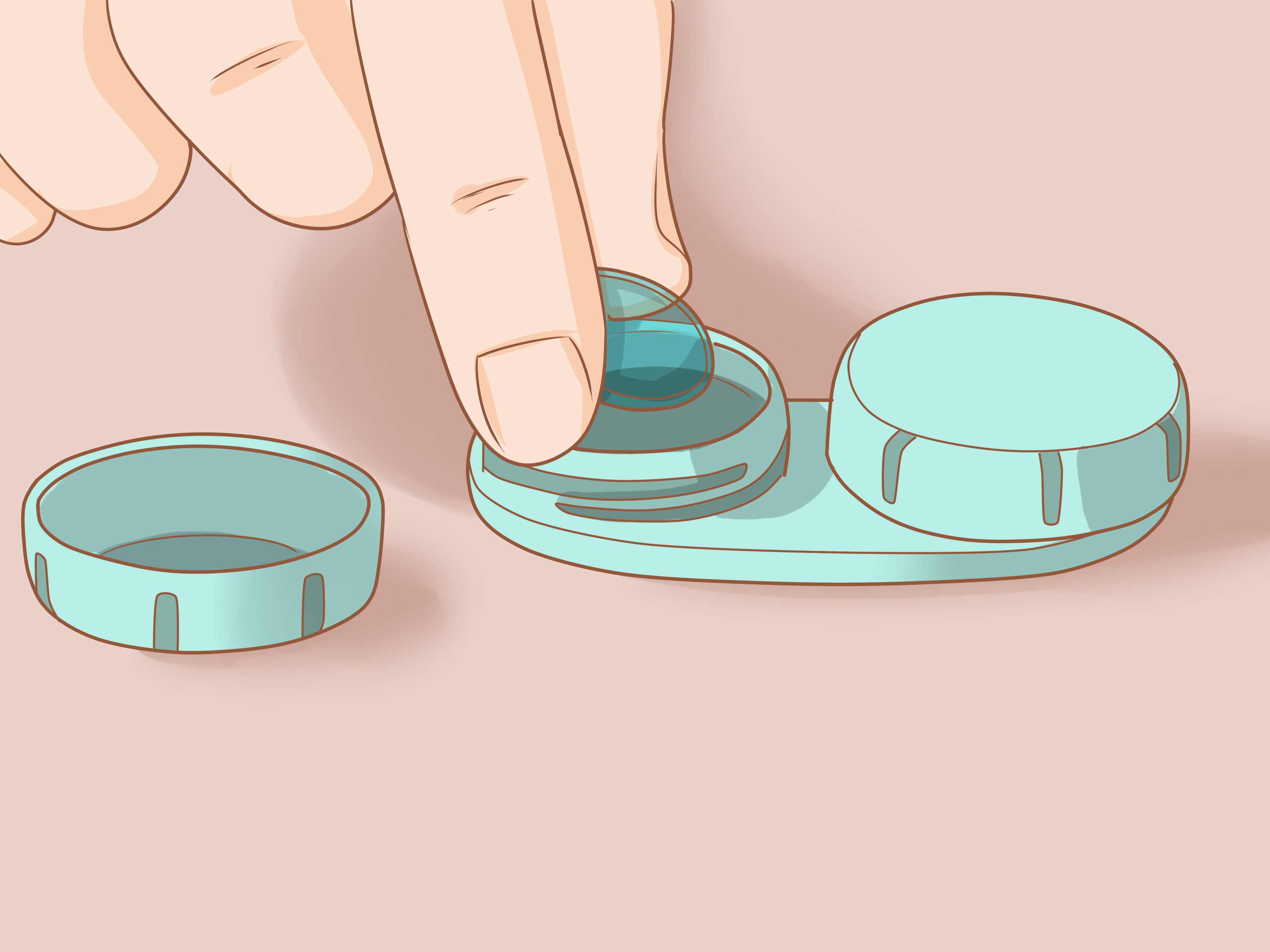 How to Insert and Remove a Scleral Lens: 12 Steps
